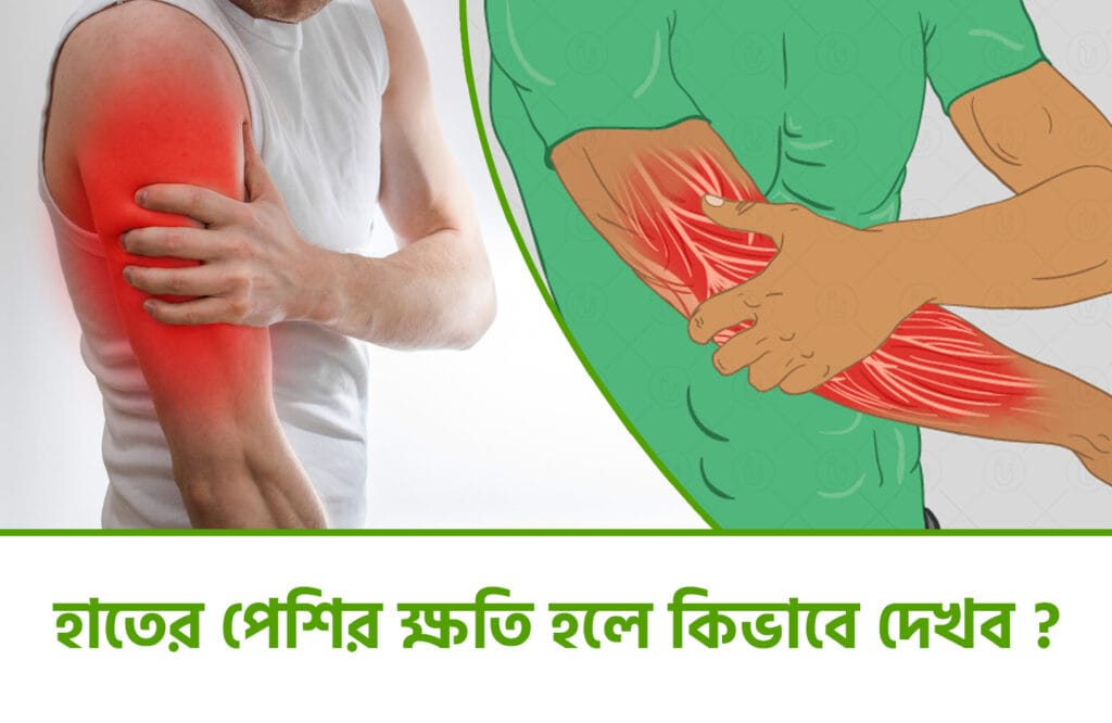 হাতের মাংসপেশিতে ব্যথা