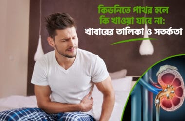 কিডনিতে পাথর হলে কি খাওয়া যাবে না