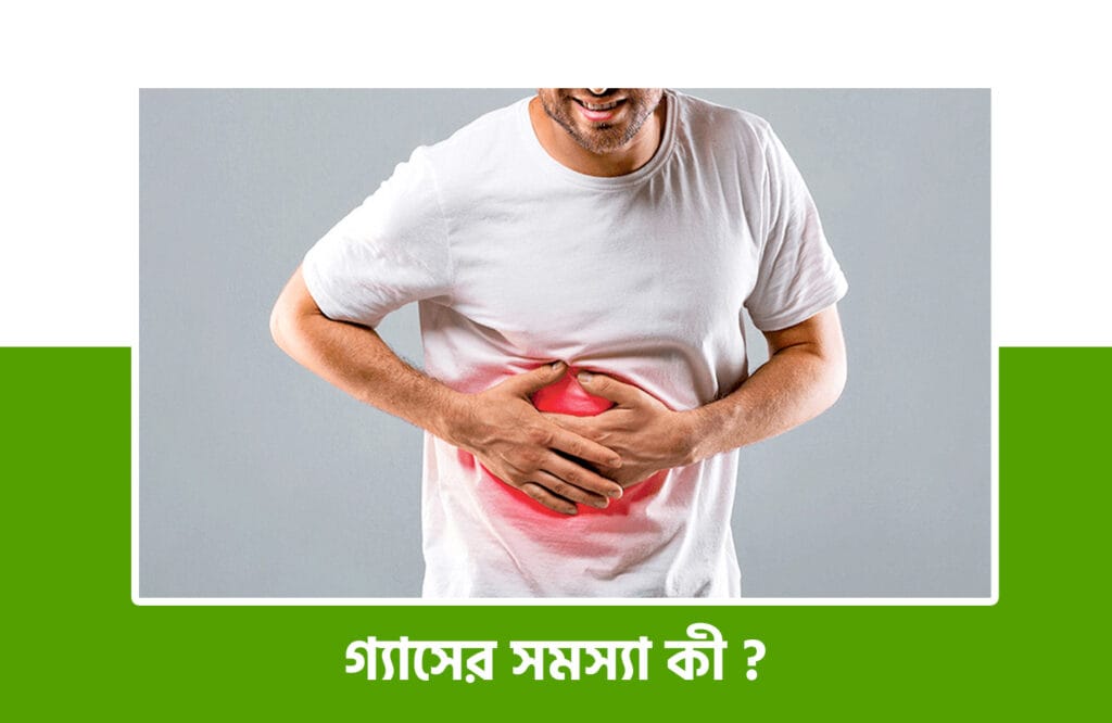 গ্যাসের সমস্যা দূর করার ঘরোয়া উপায়