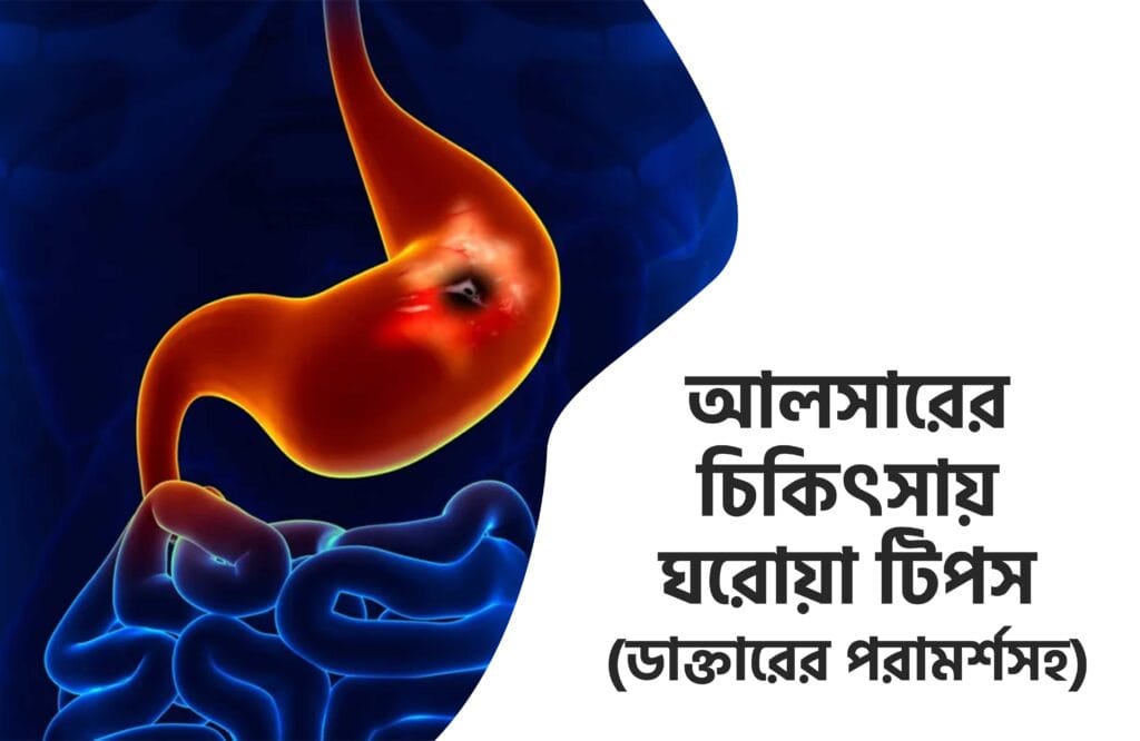 আলসার কত দিনে ভালো হয় 