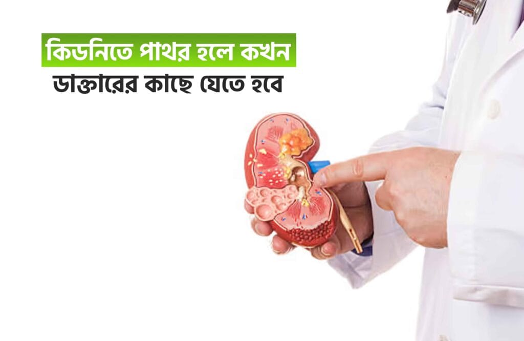কিডনিতে পাথর হলে কখন ডাক্তারের কাছে যেতে হবে