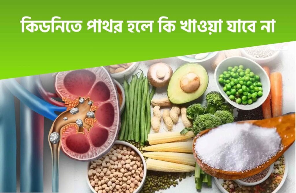 কিডনিতে পাথর হলে করণীয় কি