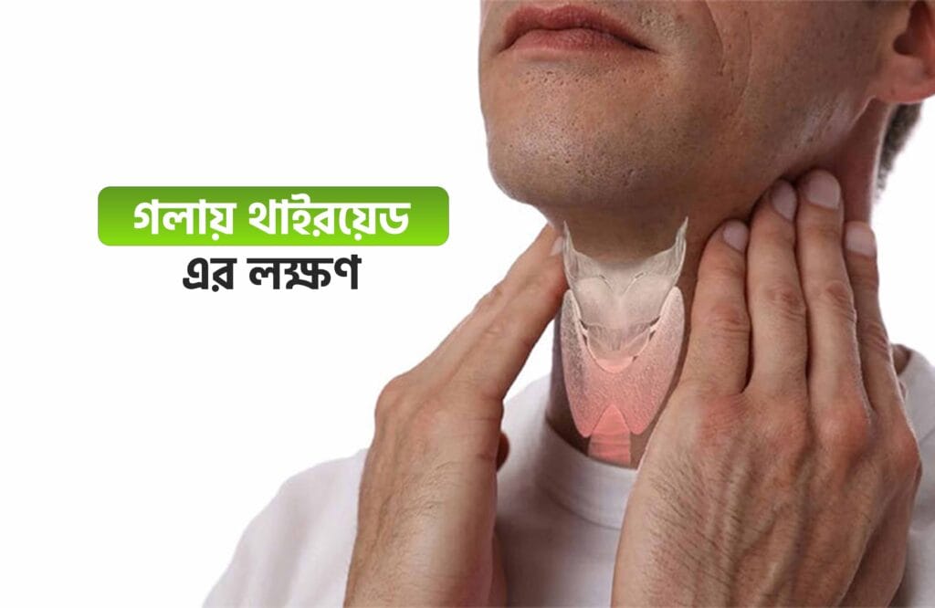 থাইরয়েড হলে কি কি সমস্যা হয়