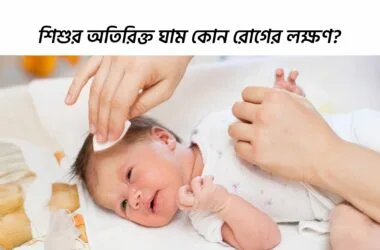 শিশুর অতিরিক্ত ঘাম কোন রোগের লক্ষণ